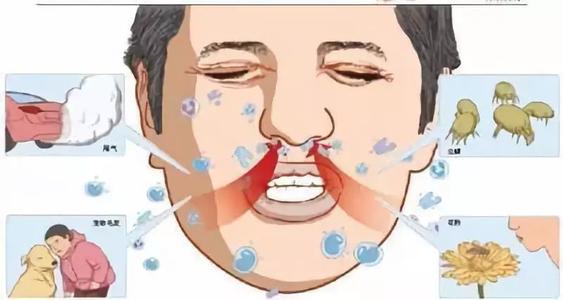 鼻咽癌临床分期t0-m3以及治疗方案