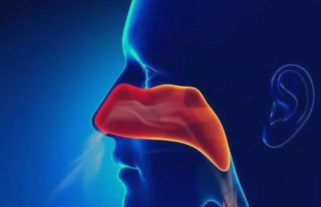 鼻炎会引起鼻癌吗