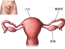 卵巢囊肿典型症状及发病原因有哪些